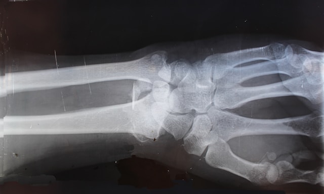 Understanding TCM Bone Setting When Traditional Bodywork Becomes Part of a Wellness Routine